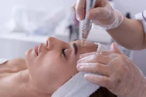 Mikrojehličková radiofrekvence: Omlazující procedura obličeje - foto 01