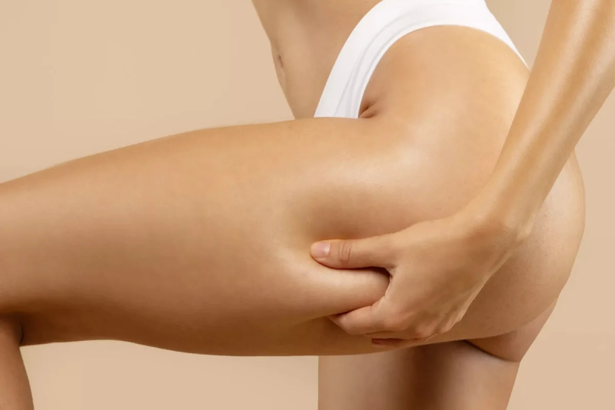Neinvazivní liposukce: Ultrazvuková kavitace - foto 03