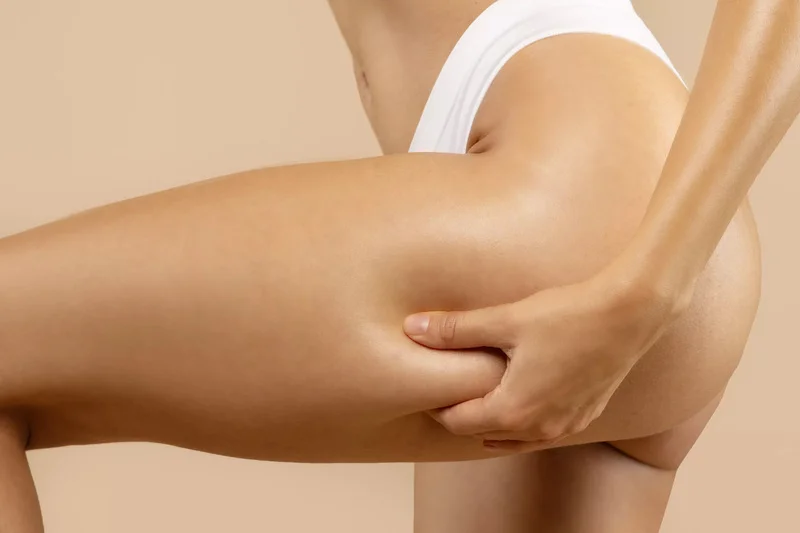 Neinvazivní liposukce: Ultrazvuková kavitace - foto 03